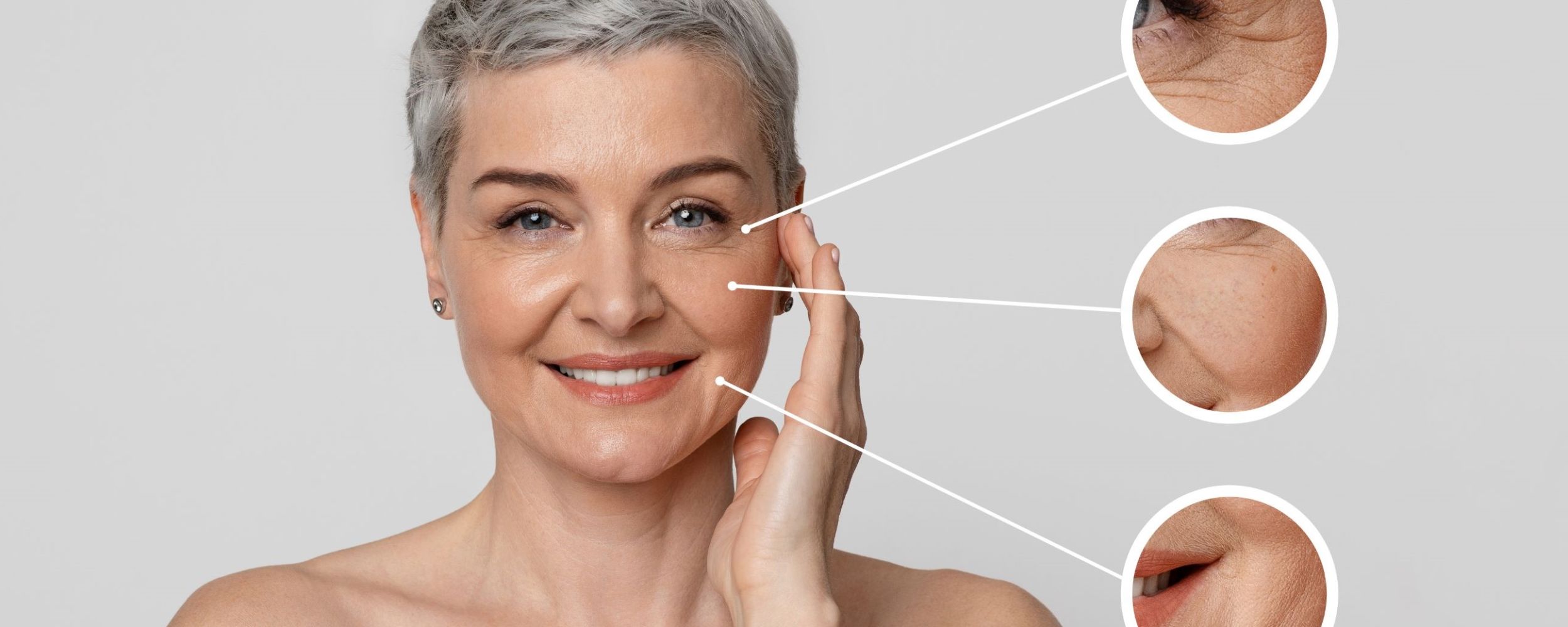 Anti-wrinkle treatments
