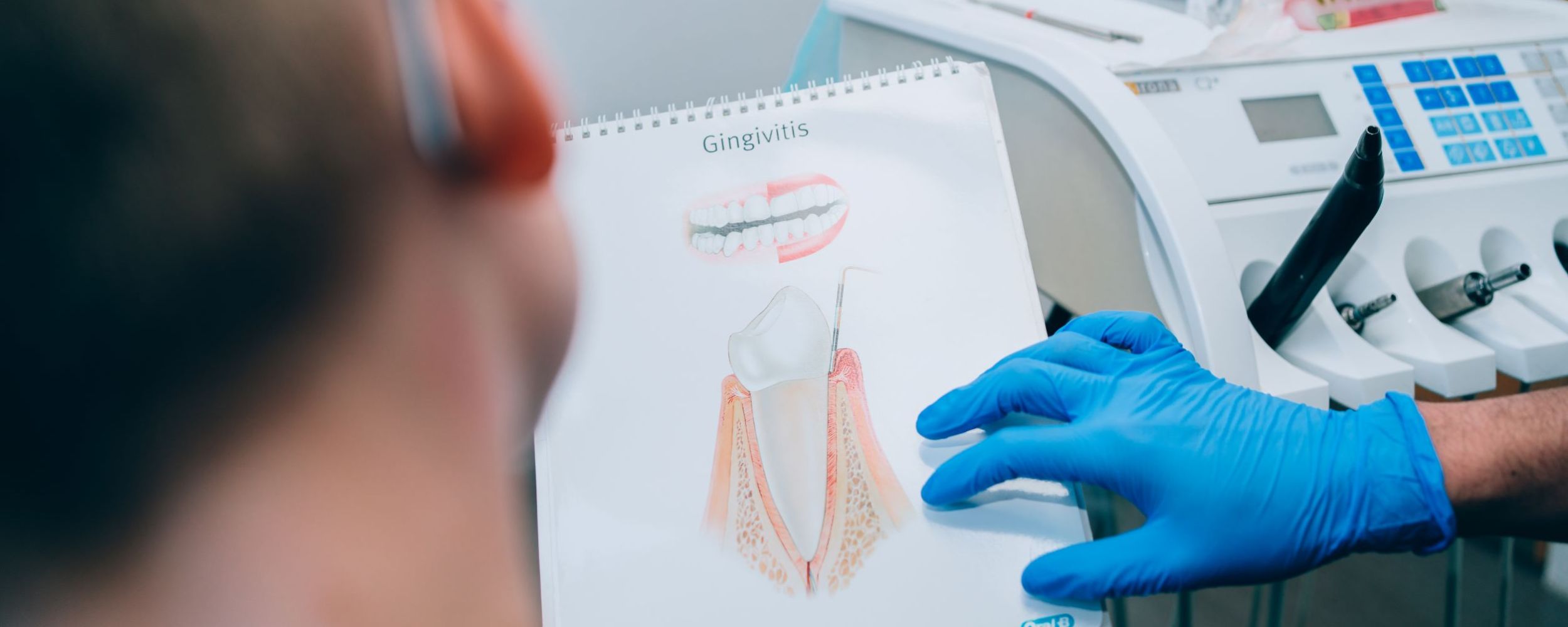 Mouth ulcers